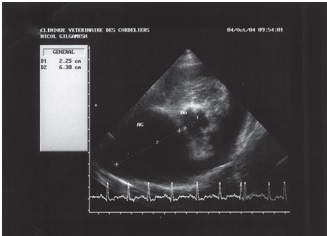 Fig 4 Echographie 1